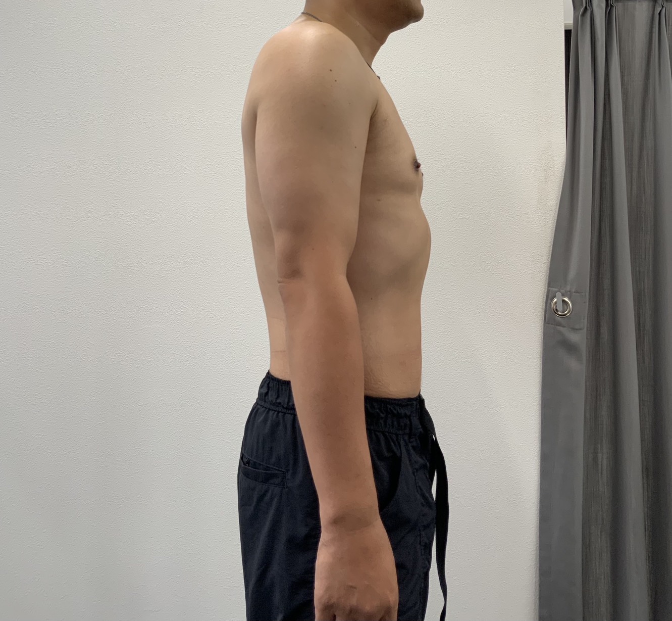 アフター写真（男性横向き）