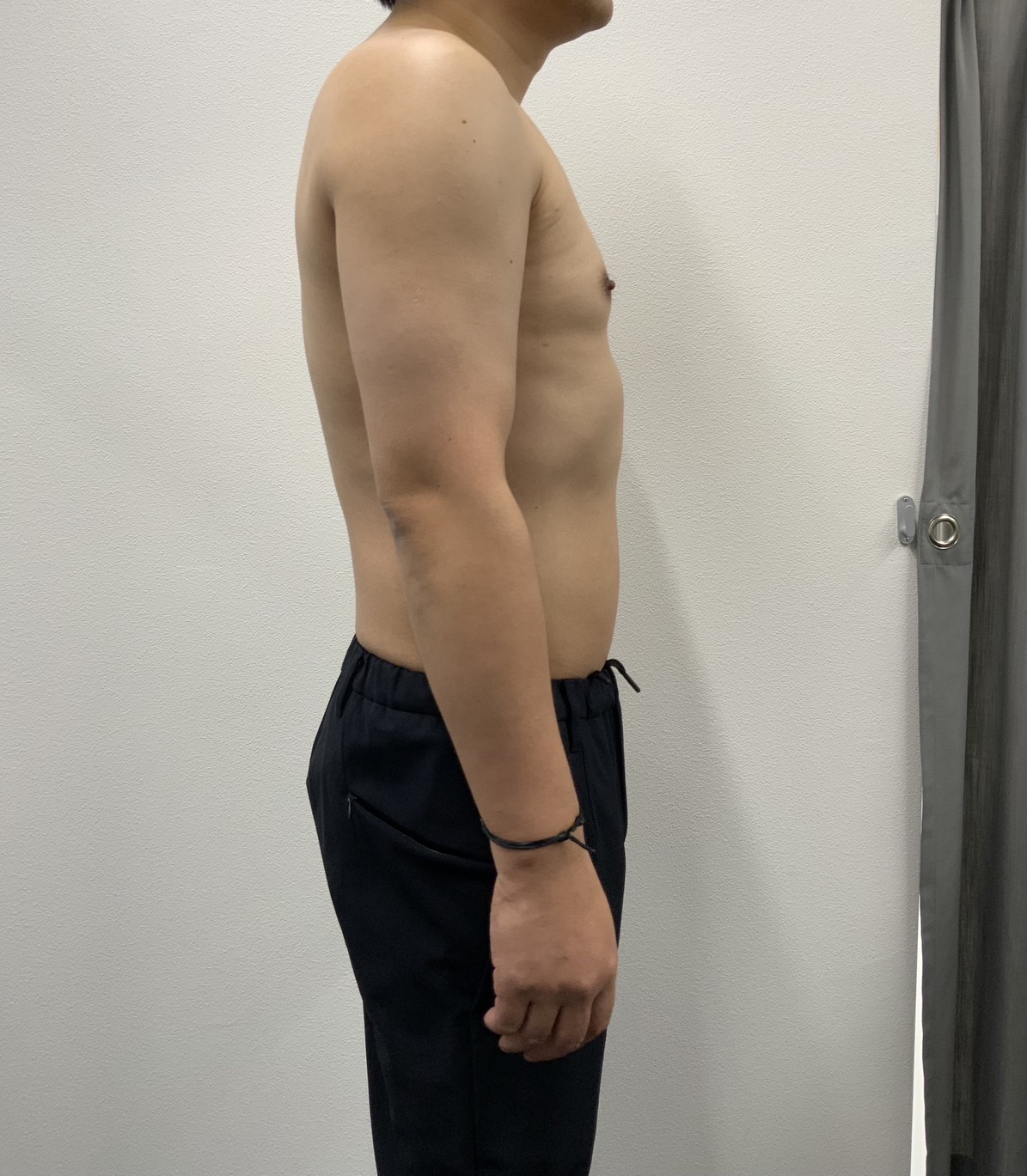 ビフォー写真（男性横向き）